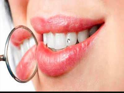 Tooth Jewellery